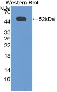 CD119 / IFNGR1 Antibody (aa23-253, PE)