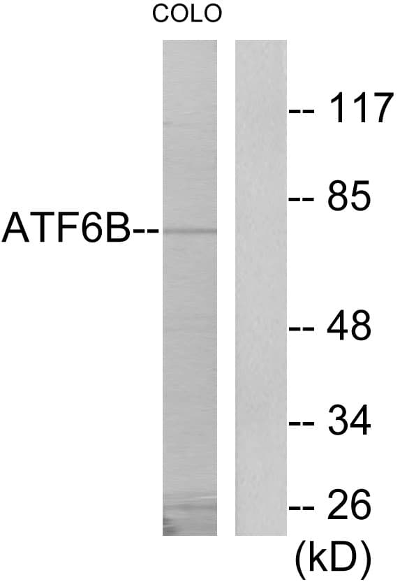 CREBL1 / ATF6B Antibody (aa401-450)