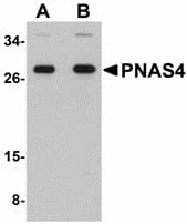 DESI2 / PPPDE1 Antibody
