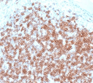 Monoclonal Mouse anti-Human CD22 Antibody (clone CDLA22-1, Azide-free,BSA-free, IHC)