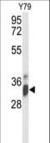 IMP4 Antibody (aa215-243)