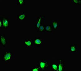 HIST1H2BD Antibody