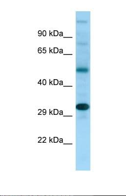 NDRG4 Antibody (C-Terminus)