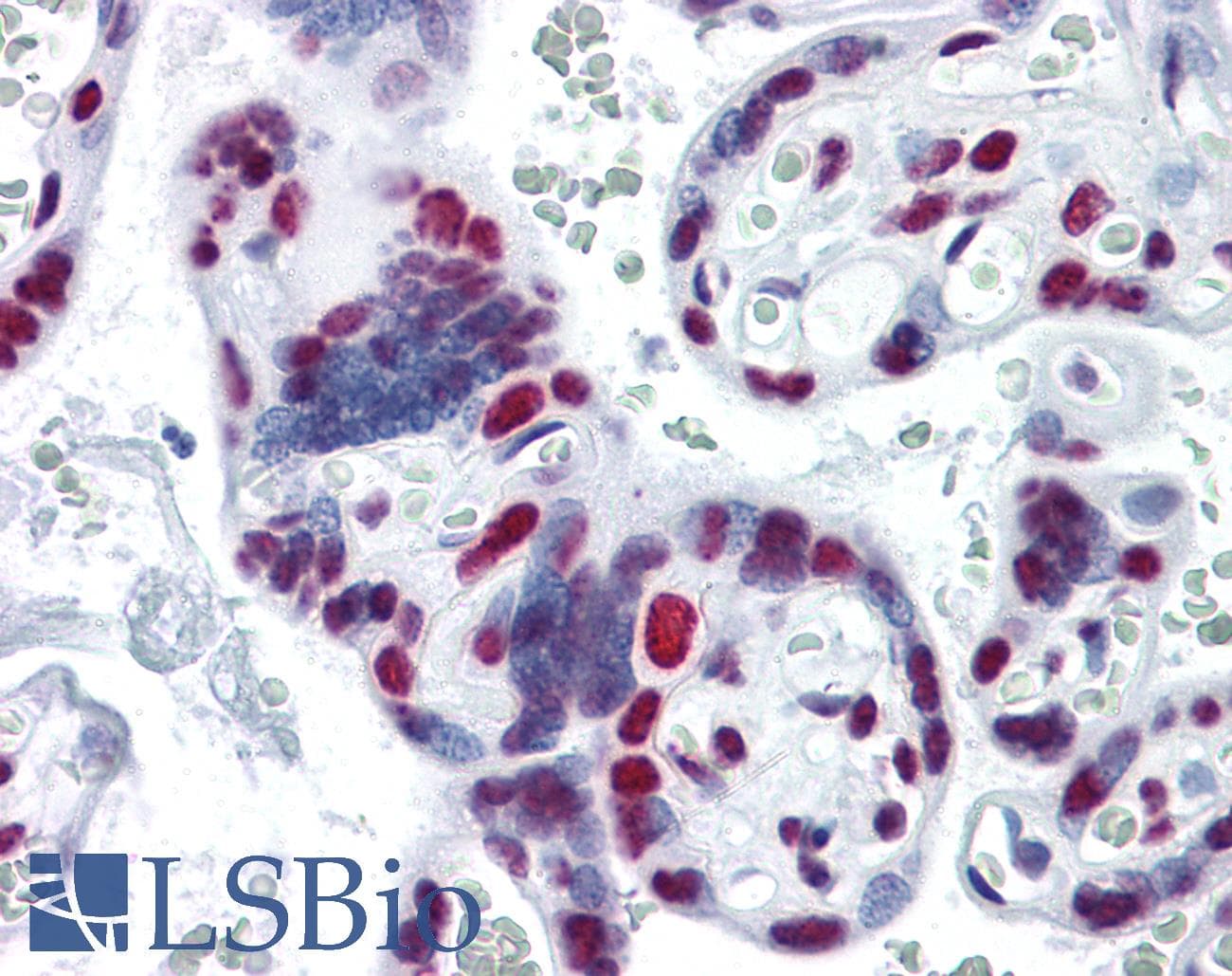 IHC-plus™ HNRPM / HNRNPM Antibody (clone 3F7)