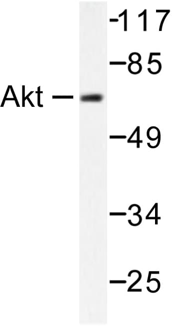 Polyclonal Rabbit anti-Human AKT1 + AKT2 + AKT3 Antibody (Asp302, IHC, WB)