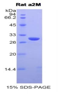 Rat A2M / Alpha-2-Macroglobulin Protein (Recombinant His)