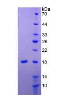 Human IL24 Protein (Recombinant His, N-Terminal)