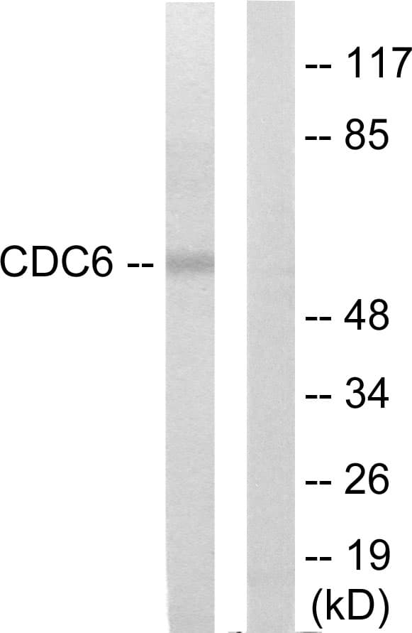 Polyclonal Rabbit anti-Human CDC6 Antibody (aa491-540, WB)