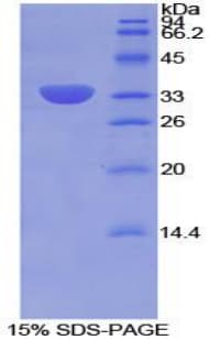 Rat ITGB2 / CD18 Protein (Recombinant His-T7)
