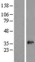 SNX11 Protein (Over-Expression Lysate Myc-DDK (Flag))