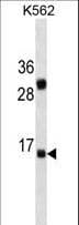 Monoclonal Mouse anti-Human IL2 Antibody (aa50-77, WB)