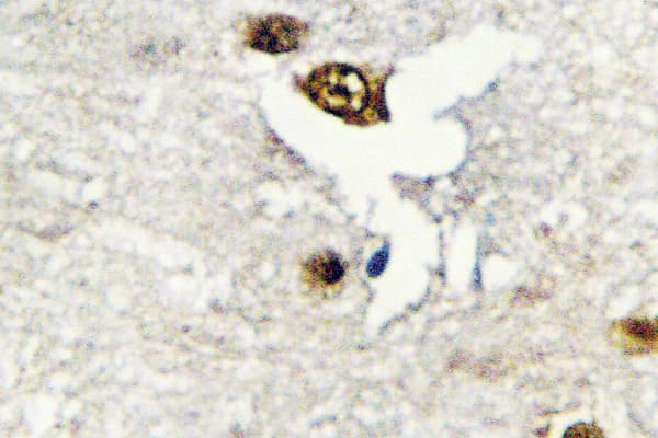 Polyclonal Rabbit anti-Human CUGBP1/2 Antibody (Lys95, IHC, WB)