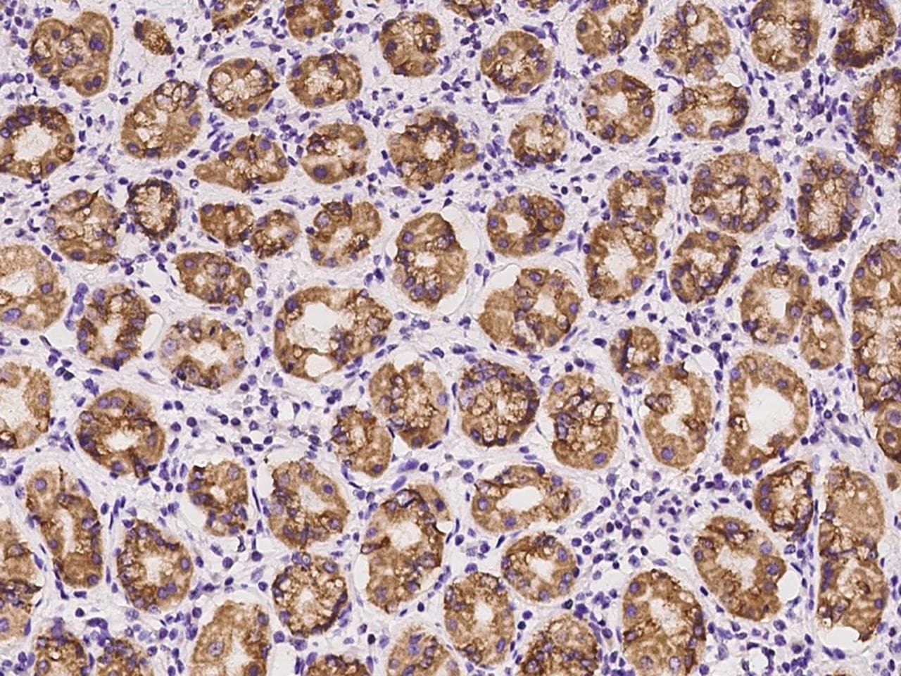 CCL2 / MCP1 Antibody