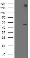 LPL / Lipoprotein Lipase Antibody (clone OTI3C8, Carrier-free)