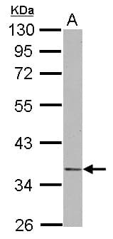 Polyclonal Rabbit anti-Human NDE1 Antibody (WB)