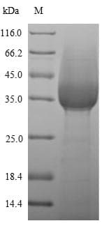 Mouse Ly6g / Gr1 Protein (Recombinant 6His-SUMO, N-terminus)