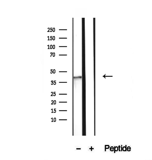 Polyclonal Rabbit anti-Human NSDHL Antibody (IHC, WB)