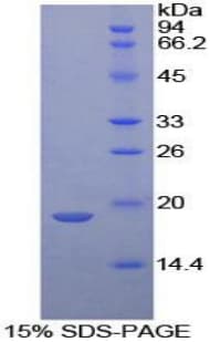 Mouse NTS / NT / Neurotensin Protein (Recombinant His-T7)