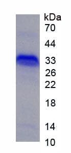 Rat NGF Protein (Recombinant His, N-Terminal)