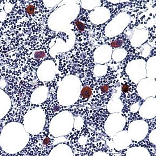 Monoclonal Mouse anti-Human ITGB3 / Integrin Beta 3 / CD61 Antibody (clone Y2/51, IHC)