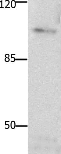 Polyclonal Rabbit anti-Human FAK / Focal Adhesion Kinase Antibody (IHC, WB)