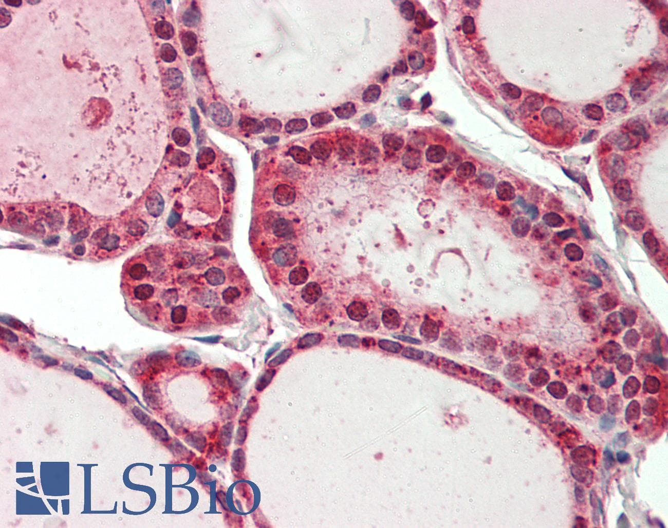 IHC-plus™ HECTD1 Antibody (aa1-50)