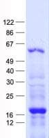 Human ZFP57 Protein (Recombinant His, N-Terminal)
