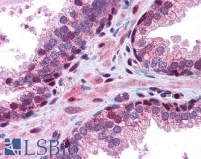 IHC-plus™ C20orf11 / TWA1 Antibody