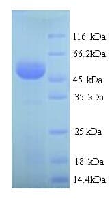 Mouse AGXT / SPT Protein (Recombinant 6His, N-terminus)