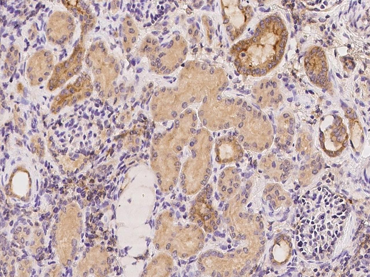 CAPN15 / SOLH Antibody