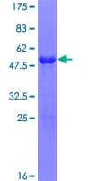 Human SPAG16 Protein (Recombinant GST)