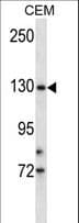TMPRSS9 Antibody (aa124-153)