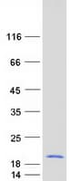 Human UQCRB Protein (Recombinant Myc-DDK (Flag))