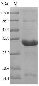Arabidopsis thaliana MSRB7 Protein (Recombinant 6His-SUMO, N-terminus)