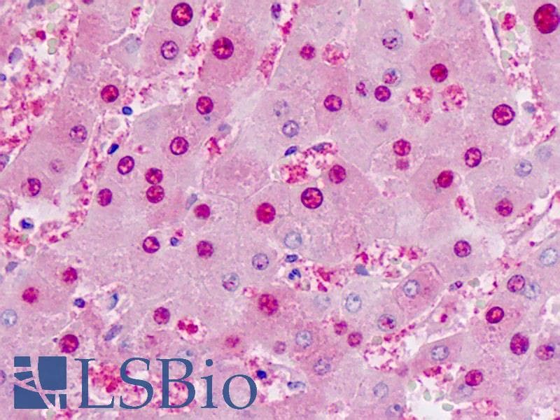 IHC-plus™ Monoclonal Mouse anti-Human CRTC1 / MECT1 / TORC1 Antibody (clone 1B5, IHC, IF, WB)