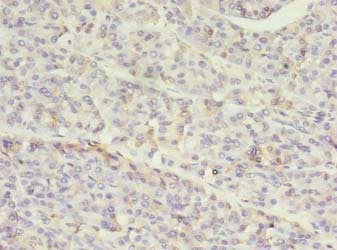 SETD7 / SET7 Antibody