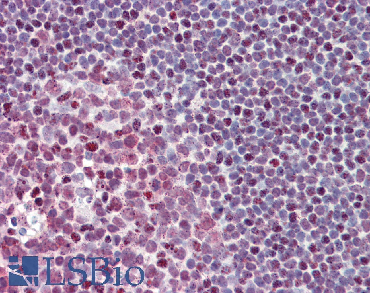 IHC-plus™ FUBP1 Antibody (aa160-174)