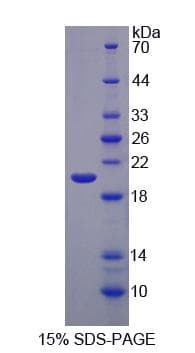 Mouse EIF2AK3 / PERK Protein (Recombinant His-S)