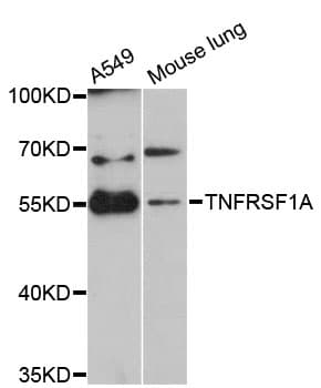 Polyclonal Rabbit anti-Human TNFRSF1A / TNFR1 Antibody (IF, WB)