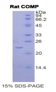 Rat COMP / THBS5 Protein (Recombinant His)
