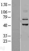 ADCK3 / CABC1 Protein (Over-Expression Lysate Myc-DDK (Flag))