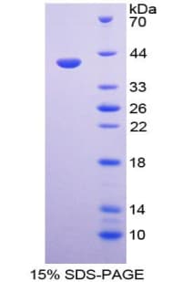 Human APAF1 / APAF-1 Protein (Recombinant His-T7)