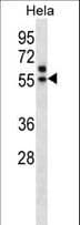 TADA3 / ADA3 Antibody (aa386-414)