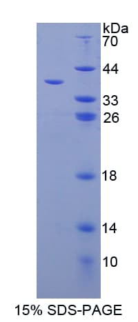 Mouse GAL4 / Galectin 4 Protein (Recombinant His-T7)