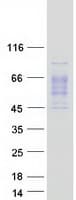 Human CD121b / IL1R2 Protein (Recombinant Myc-DDK (Flag))