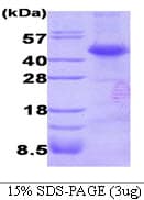 Human DTNBP1 / Dysbindin Protein (Recombinant His)