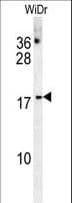 CHCHD2 Antibody (aa74-103)