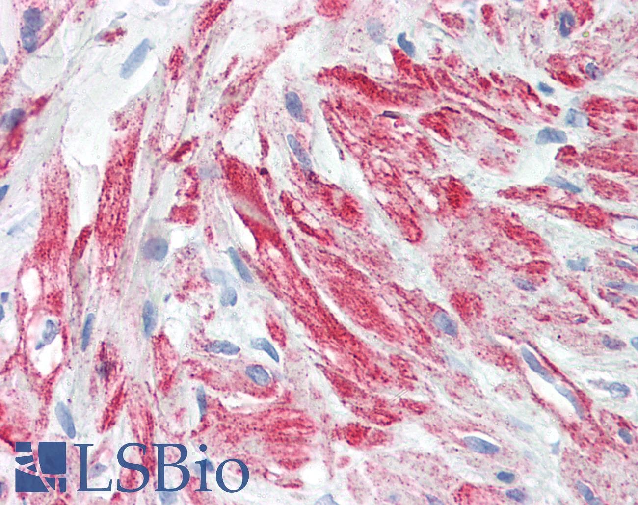 IHC-plus™ Monoclonal Mouse anti-Human ACTB / Beta Actin Antibody (clone 1E7, IHC, WB)