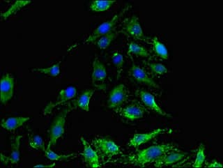 GSK3B / GSK3 Beta Antibody