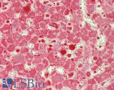 IHC-plus™ FTL / Ferritin Light Chain Antibody (aa 2-175)